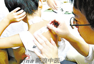 灸法的種類  你知道多少？